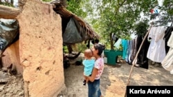 Desnutrición infantil, Camotán, Guatemala. [Fotografía: Karla Arévalo/VOA]