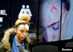 Gabriella Engels, who claims to have been assaulted by Grace Mugabe, arrives for a news conference in Pretoria, South Africa, Aug. 17, 2017.