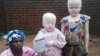 Une femme albinos malawite assassinée pour ses os