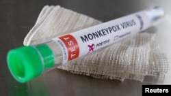 Un tubo de ensayo con la etiqueta "virus de viruela del mono positivo". Foto Reuters.